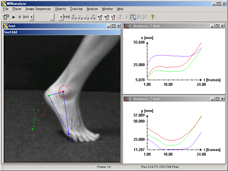 video analysis